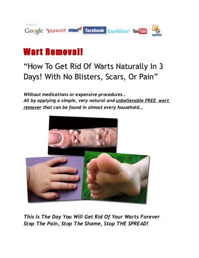 Wart Removal - Get Rid of Your Wart good and you