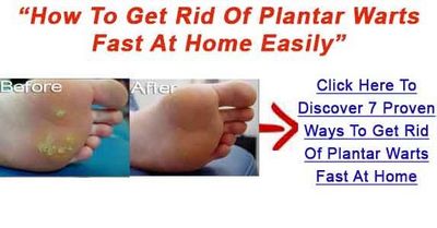 Wart Removal - Get Rid of Your Wart to come easy for everyone