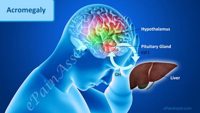 What Are Pituitary Tumors? which affect