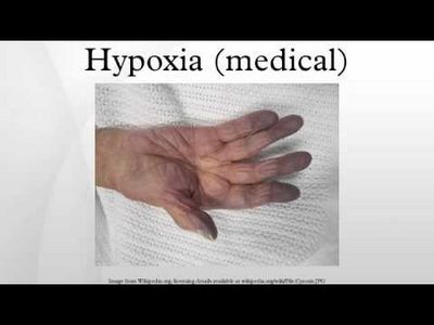 What Is Hypoxia? specific and exact