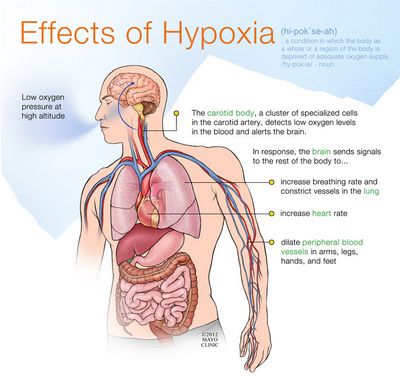 What Is Hypoxia? to avoid